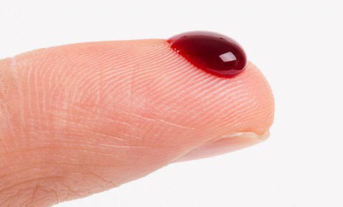 Giấc Mơ Thấy Máu kubet 🎖 ku casino đăng ký kubet đăng nhập ku 24/7: Điềm Báo Tốt Hay Xấu?